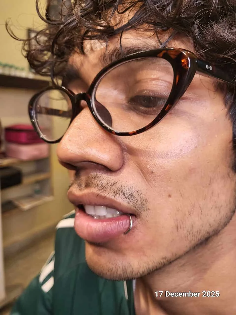 Man wearing a silver lip ring after professional lip piercing in Palam